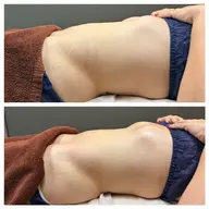 【1番人気】キャビリポプロ×ノンエフ痩身ケア《1部位》40分