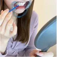 平日15時迄🕒セルフホワイトニング（9分2セット）1回