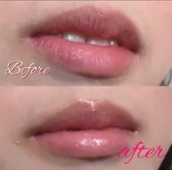 リップエステ+まつ毛パーマ(上)