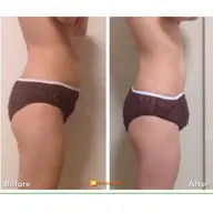 🌸人気No1🌸 スピード痩身♪劇的スリム★がっつり全身90分￥22000→￥8900