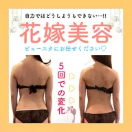 【ブライダル専用】背中の厚み・二の腕痩せはこれ💖ドレスが似合うお身体に劇的変化✨️🤍