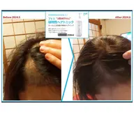 ヘッドスパ(植物性のヘアケア製品も会員で購入できます)