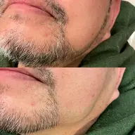 💈眉毛アイブロウ＋シェービング（お顔剃り）¥3,300          眉毛のデザイン、ヒゲのデザイン、お任せ下さい