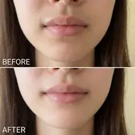 【シェービング】清潔感UP★｜お顔産毛ケア｜パック付き￥5000 → ¥3,000