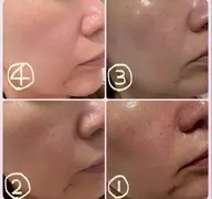 先着20名♪【満ちるハリ肌へ🫧】小顔×美肌フルコース4回