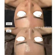 [結果重視✨] Reviハーブ2g➕オプション2種💎(デコルテ付)60分