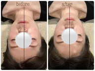 1回でも効果抜群☆小顔矯正マッサージ☆