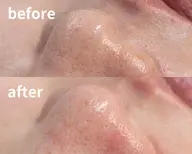 一番人気!!小鼻のwax!!