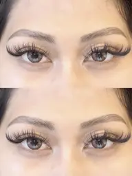 ハリウッドブロウリフト