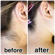 【うなじワックス脱毛】鎮静クリーム仕上げ✨女性限定