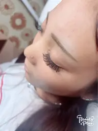 バインドロック