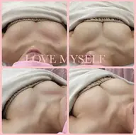 リピーター様《再来》美乳形成