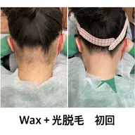 【学割U24/24歳以下以下なら社会人もOK!】うなじワックス脱毛¥2800