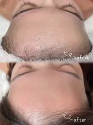 2回目以降おでこ＆アイブロウWAX