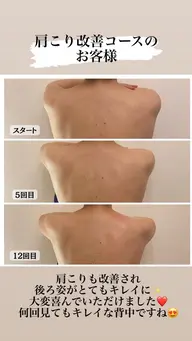 辛い肩こりバイバイコース　30分