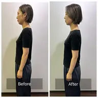 【顔も身体も楽にしたい】美容鍼×整体スタンダード★60分¥12,000→¥7,500