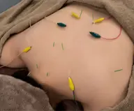 【経絡小顔美容鍼 90分】全身×小顔電気鍼+ラジオ波or顔筋リフト+筋膜ほぐし/ヒト幹整肌/ヘッド・首肩マッサージ