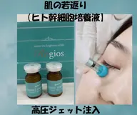 肌の若さ返り【ヒト幹細胞培養液】高圧ジェット導入19,000円→11,000円