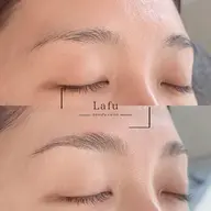 【3Dブロウリフト】