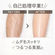 【店員おすすめ🌿】足全体脱毛（足甲指&お尻込み）