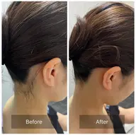 【✨1日1名様限定✨】美肌も叶う🌿女性全身脱毛