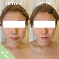 【エメラルドコース】最新マシンであの小顔体験をもう一度*50分施術