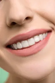 ⭐️ミニモ限定⭐️セルフホワイトニング15分1回