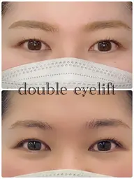 宗像市初✨✳︎ダブルアイリフト✳︎アイストレッチと専用まつ毛パーマで二重が定着しやすくなります🫶🏻