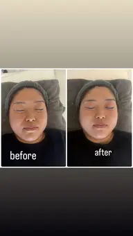 小顔フェイシャル+モデリングパック