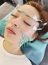 【肩コリ・腰痛・むくみOFFケア】骨盤調整×EMS×美容鍼