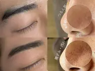 【人気セット🗣️】韓国式毛穴洗浄＋似合わせ眉毛wax✍🏻〰️メンズ/レディース　毛穴の黒ずみ＆眉毛を同時お手入れ！