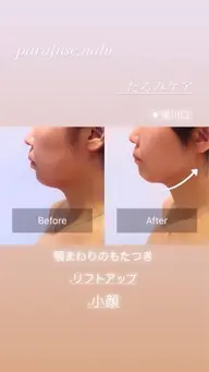 たるみケアフェイシャル&ヘッドを体験していただきお写真撮影にご協力いただける方‼︎特別価格でのご案内となります✨