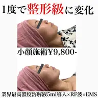 『人気No.1🩷整形級小顔施術』業界最高濃度溶解液5ml導入×RF波×EMS