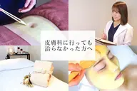 《✨平日限定✨》ダウンタイム無し🌈ニキビ/ニキビ跡/毛穴/乾燥...ピーリングと温泉パックで史上最高の仕上がりに💕