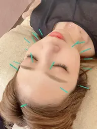 💎小顔矯正＋美顔鍼メニューをもう一度受けたい方限定クーポン💎