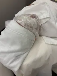 超音波エステ+トリートメントパック