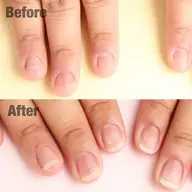 【ミニモ限定】3回コース特別価格¥29,000→¥21,000 深爪矯正長さ出し 1カラーorグラデーション✨ケア付き!