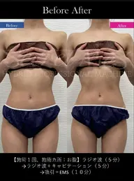 綺麗応援♥　プロ用シークレットメスマシンセルフエステ