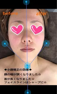 【小顔矯正】自慢の技術でスッキリとした骨格へ！30分8000円→5980円