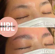 ハリウッドブロウリフト