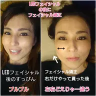 頭蓋骨からアプローチ、浮腫みを流しその場で橋⚪︎環七‼️実感✨美Dical式小顔矯正✨