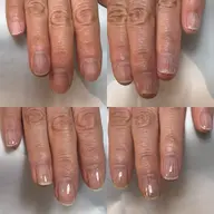 【初回カウンセリング無料】剥離爪ハンドケア