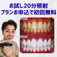 お試し20分照射ホワイトニング