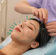 【女性大人気No.1✨】 リフトアップやむくみたるみに◎美容鍼60分