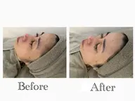 今話題👑(60分)【ヒト幹細胞順化培養液パック付】🌿オールハンドマッサージ💆♀️➕ソフトシェービングで産毛ケア