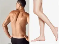 【都度払い脱毛・男女OK】全身(VIO含)キャンペーン★