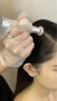 プロセルセラピーズ　頭皮