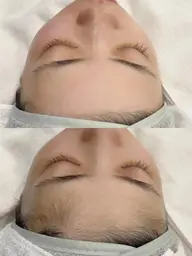 お肌のムダ毛・産毛さようなら👋🏼 ウルツヤモチで最高にモテ肌が手に入ります🧖🏼‍♀️♡見えない産毛までゴッソリ！