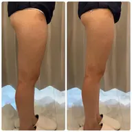 ボディ痩身お試しショット8000❤️‍🔥部分的に絞りたい方はこちらでお任せください✨