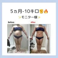 🔥効果重視の本気痩身🔥セルライト＆むくみ＆肩こりすっきりボディエステ💥最新機器で脂肪にアタック